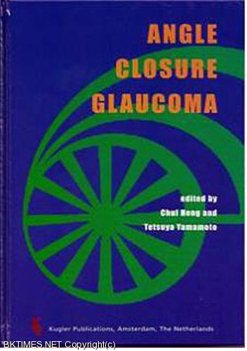 Angle Closure Glaucoma